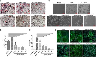 Hexane Fraction of Turbo brunneus Inhibits Intermediates of RANK-RANKL Signaling Pathway and Prevent Ovariectomy Induced Bone Loss